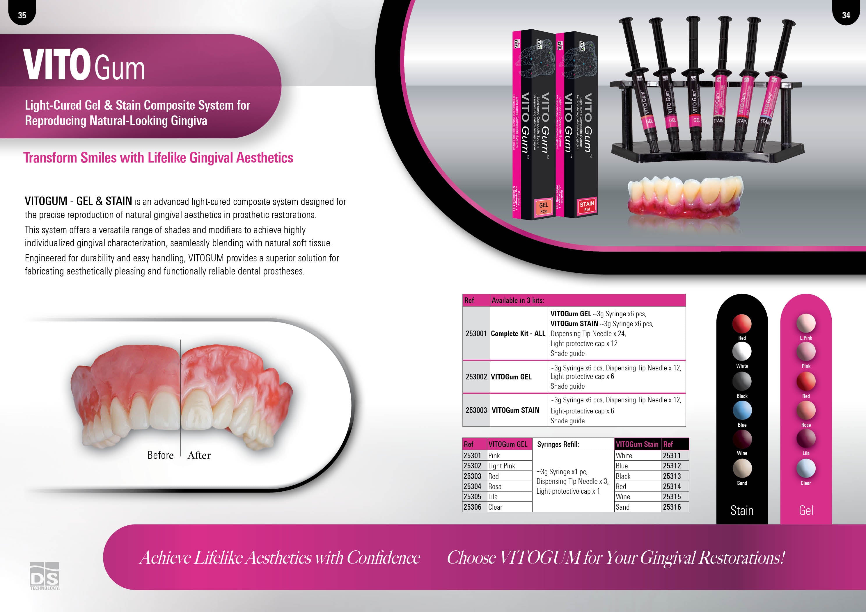 VITOGUM STAIN Light-Cured Gel Composite System for Reproducing Natural-Looking Gingiva