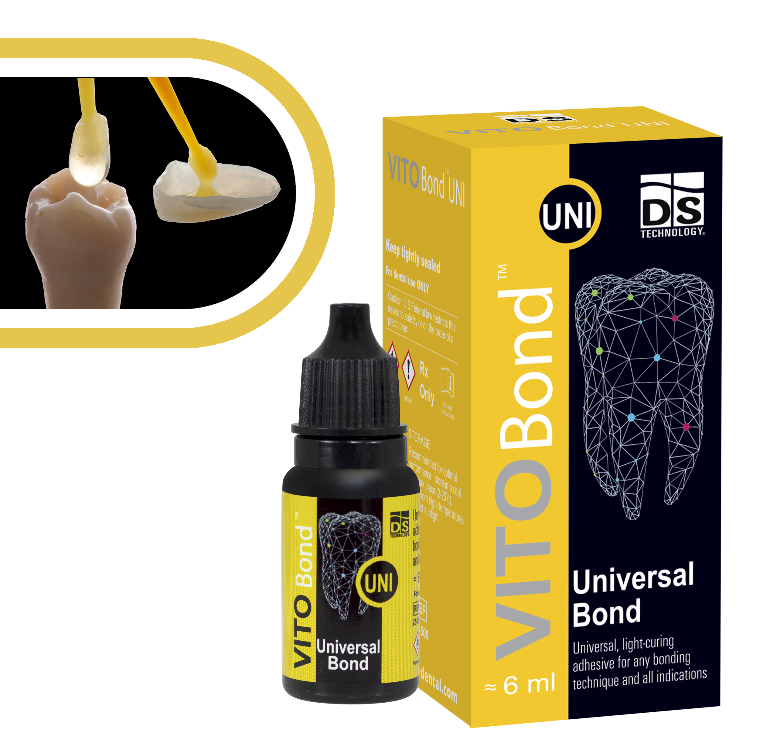 VITO Bond UNI — Universal Light-Cured Bonding Agent (6ml Bottle)