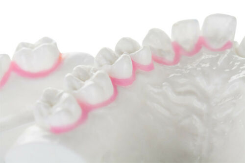 Top Blockout Wax - Denture Wax - Model Wax