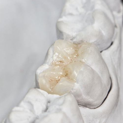 Top PC Spacer - Die Preparation 0.5 fl.oz