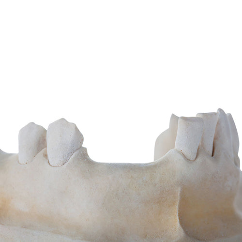 Top Blockout Wax Aluminum Jar