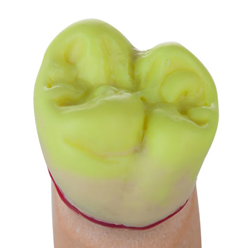 Top Cervical Wax Compact Cylinder