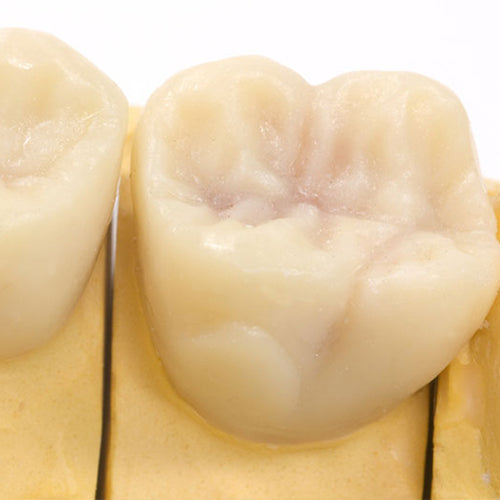 Top Diagnostic Wax