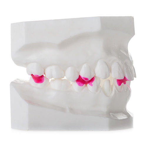 Top Sticky Wax - Denture Wax