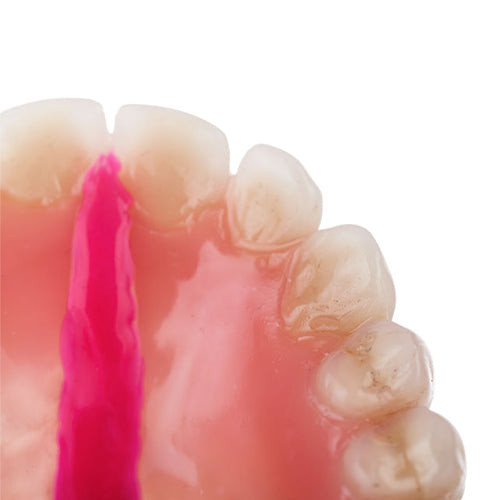 Top Sticky Wax - Denture Wax