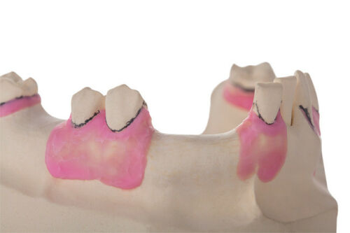 Top Blockout Wax - Denture Wax - Model Wax
