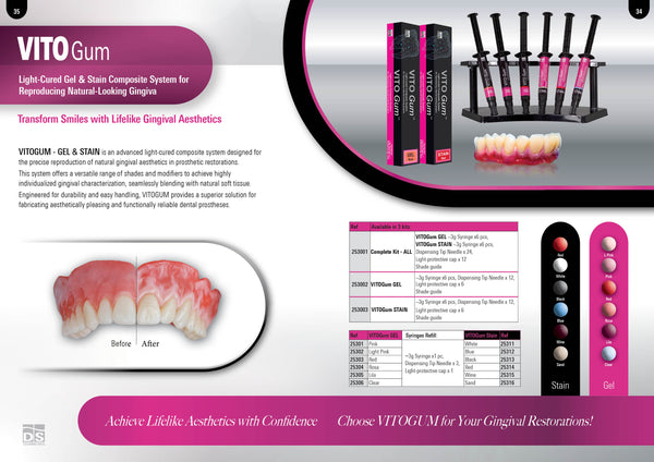 VITOGUM GEL Light-Cured Gel Composite System for Reproducing Natural-Looking Gingiva