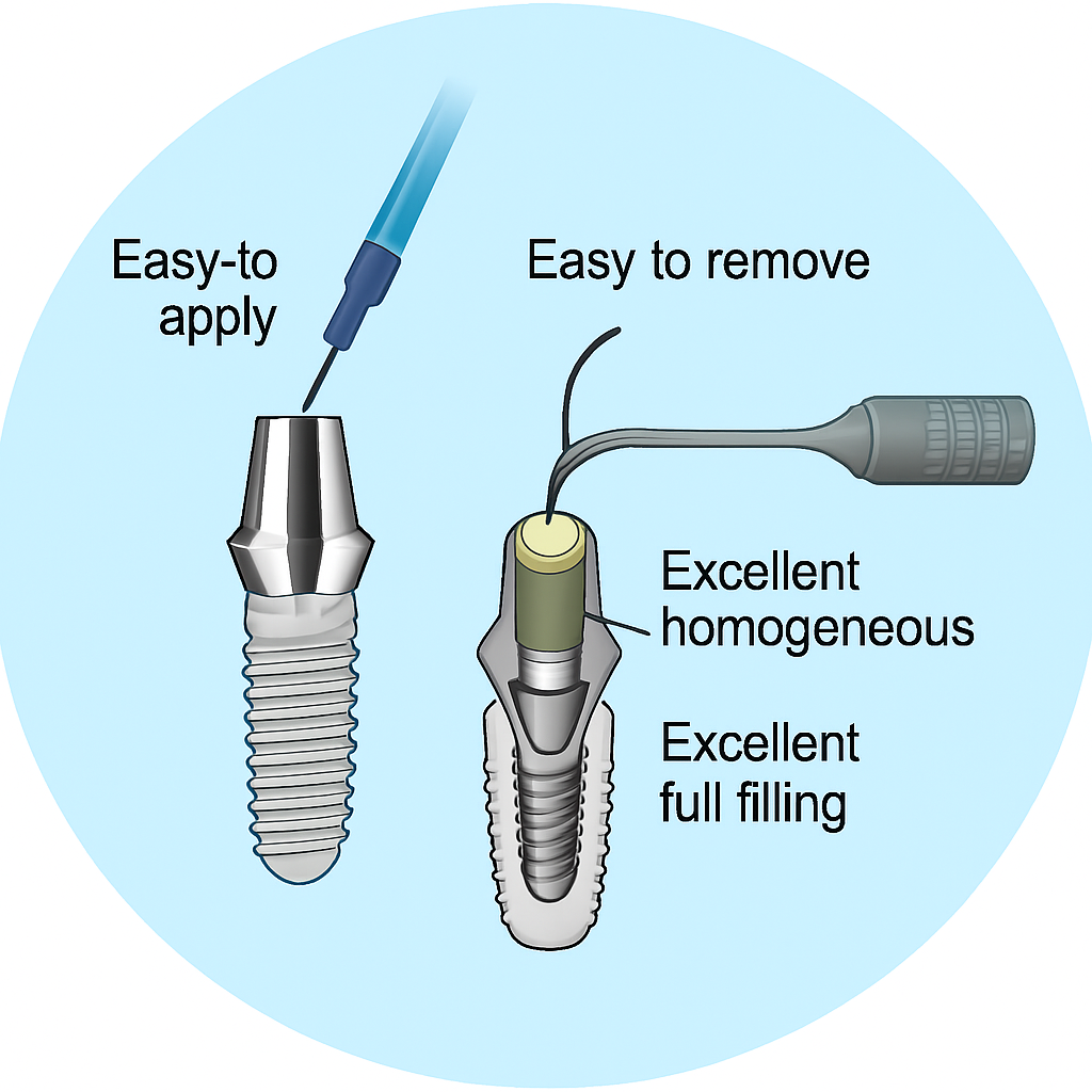 VITO Plug IMPLA KIT — Implant Screw Channel Composite (Dentine 2g × 5 Syringes)