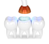 files/gel_preox.png