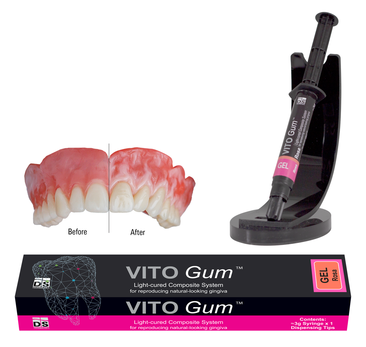VITOGum GEL — Light-Cured Gum Composite Refill (Red 3g Syringe)