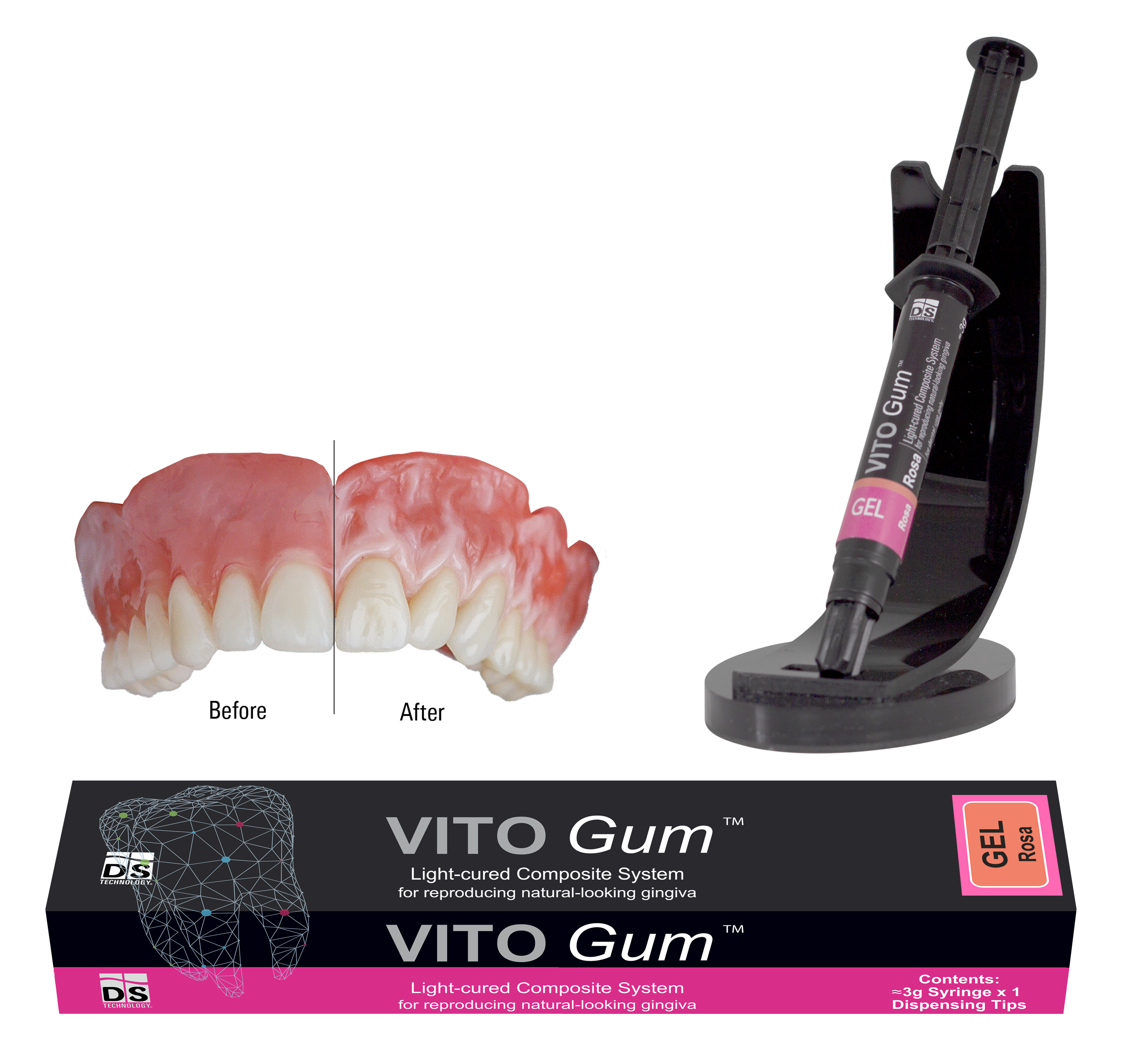 VITOGum GEL — Light-Cured Gum Composite Refill (Pink 3g Syringe)